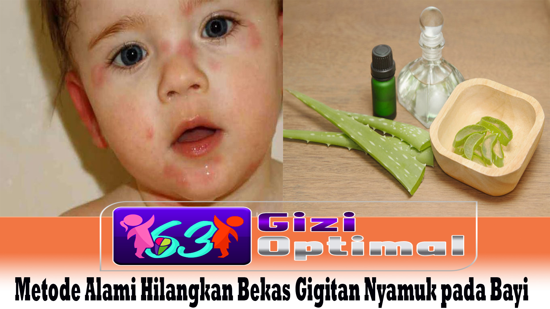 Metode Alami Hilangkan Bekas Gigitan Nyamuk pada Bayi