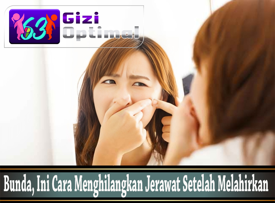 Bunda, Ini Cara Menghilangkan Jerawat Setelah Melahirkan
